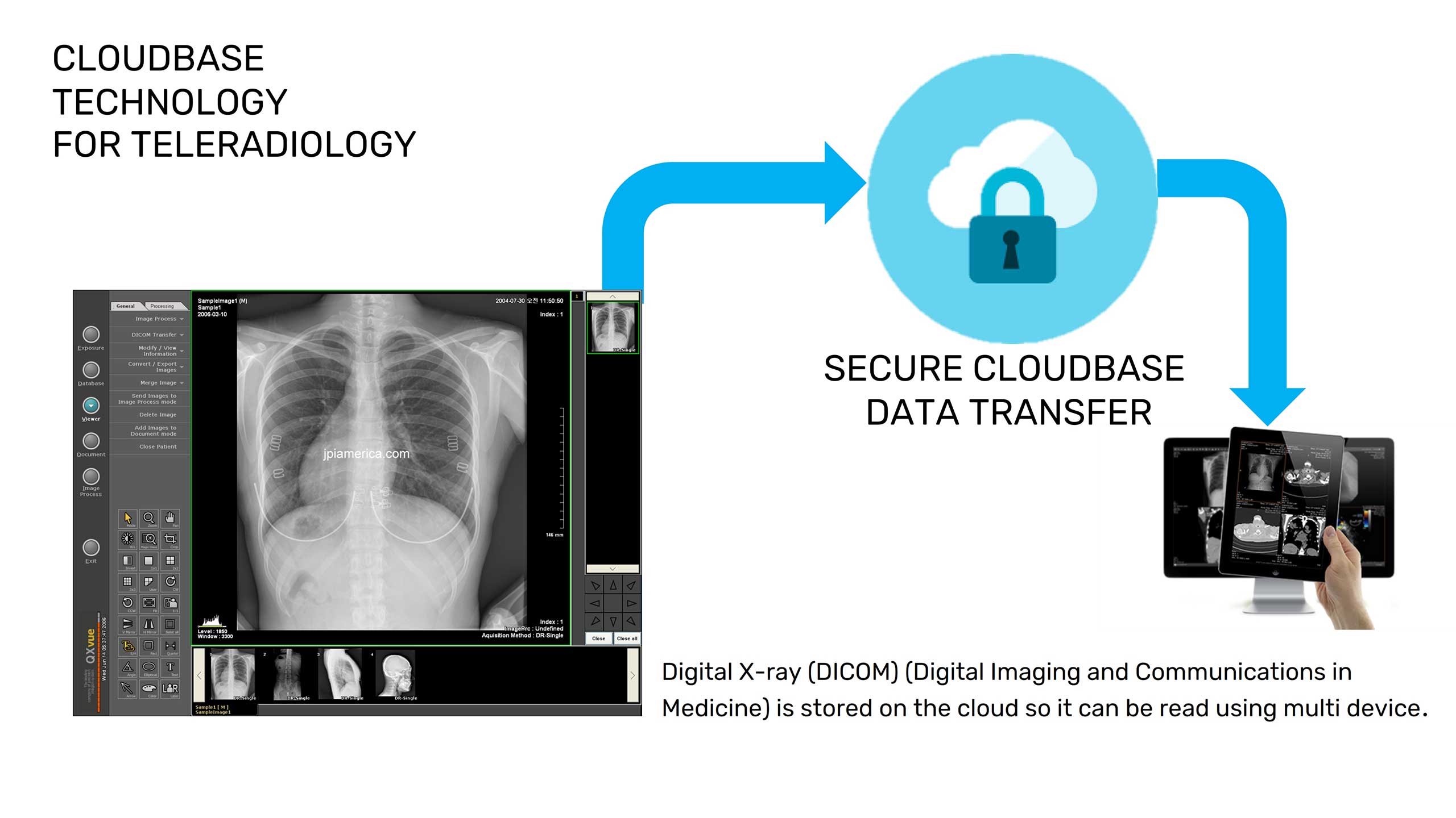 MadiCloud_CloudBase Teleradiology