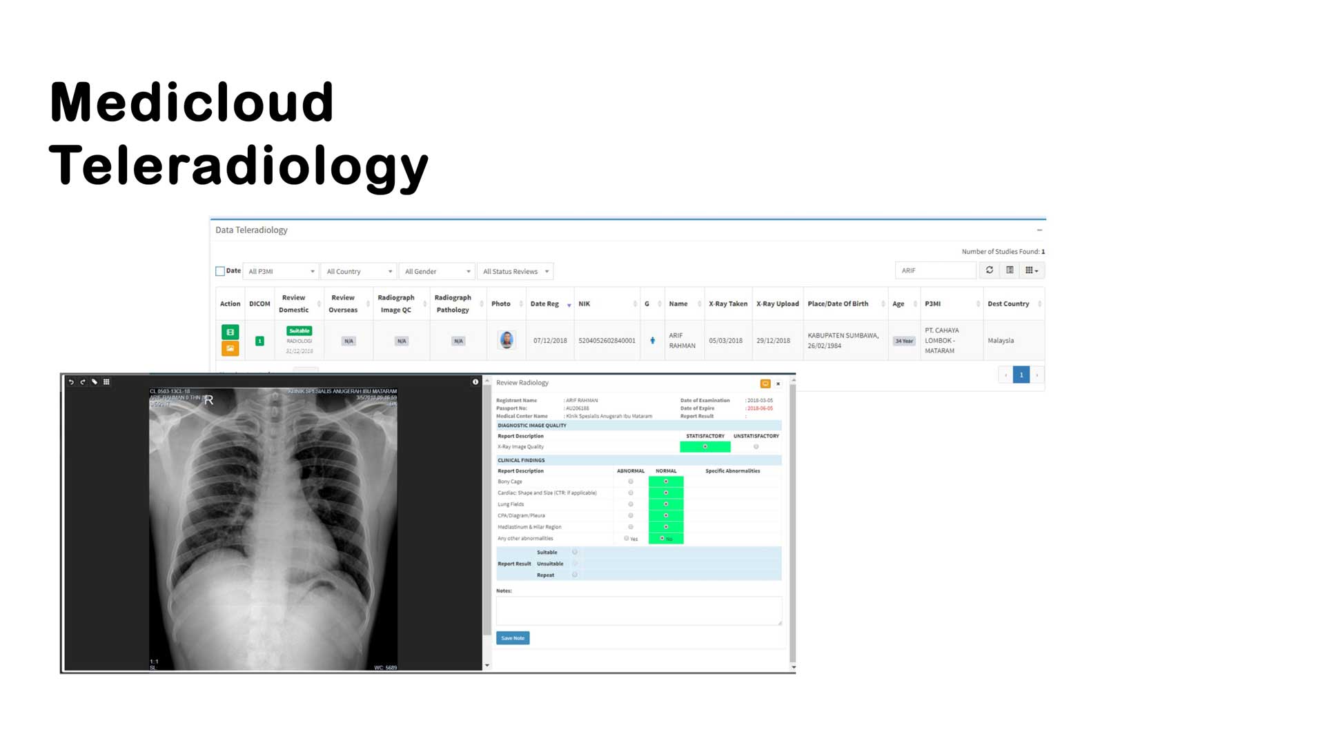 medicloud-teleradiology